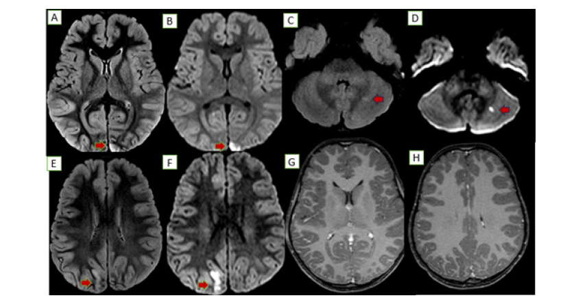 Click here to view Large figure 2