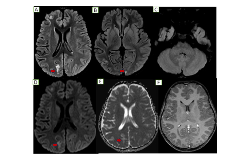 Click here to view Large figure 3