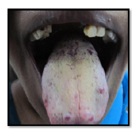 Click here to view Large image 1