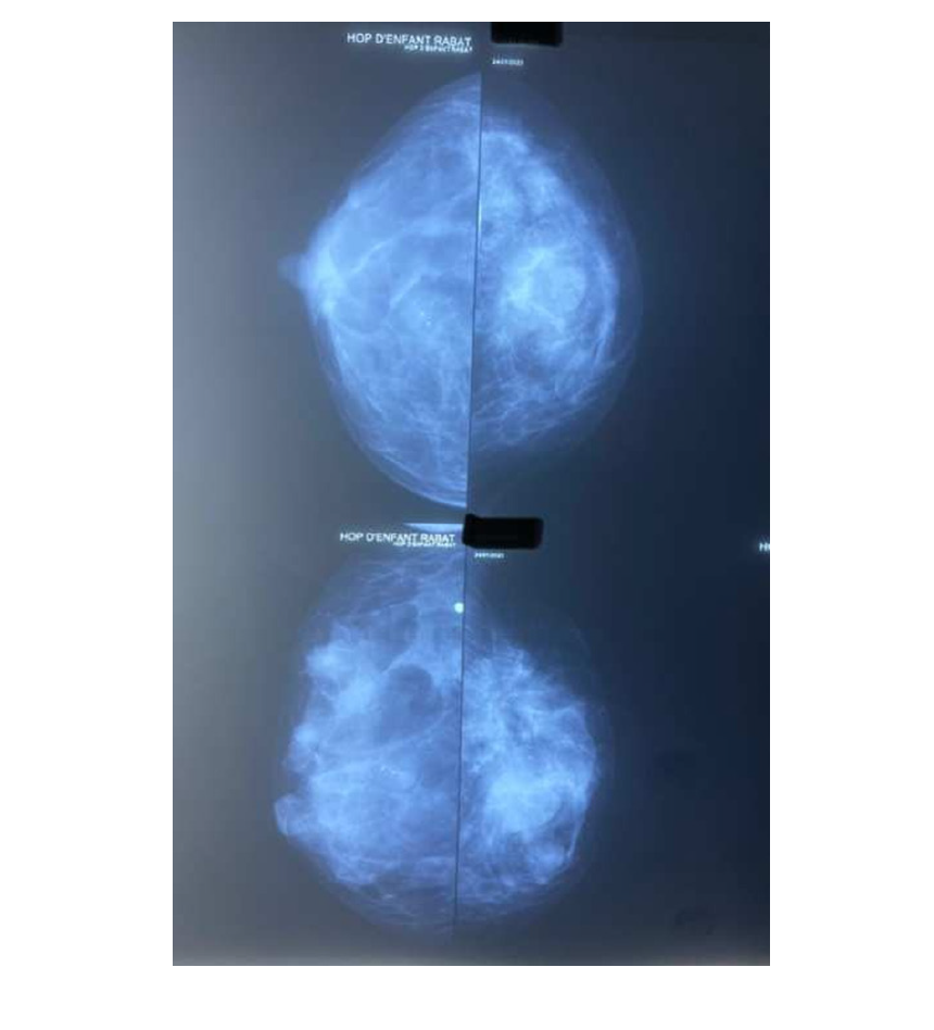 Click here to view Large image 1